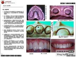 口腔备牙视频,口腔备牙操作步骤解析与技巧展示